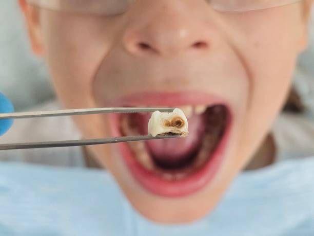 Best Emergency Dental Services for Seniors in Lebanon South, PA